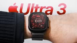 Top 10 Best Smart Watches In The World 2026